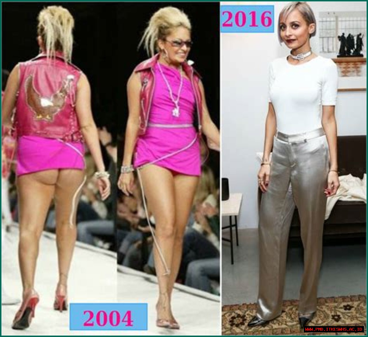 Nicole Richie is losing her weight rapidly. Her story of weight loss