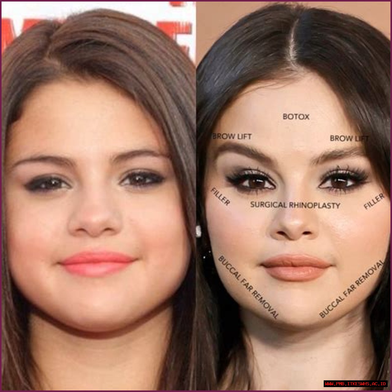 What She Looks Like Before and After Surgery